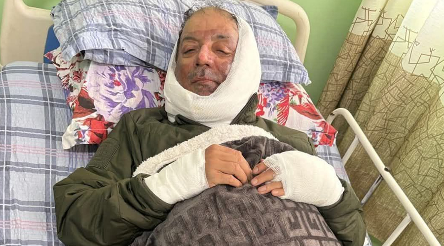पोखरा महानगरका मेयर आचार्य अस्पतालबाट डिस्चार्ज